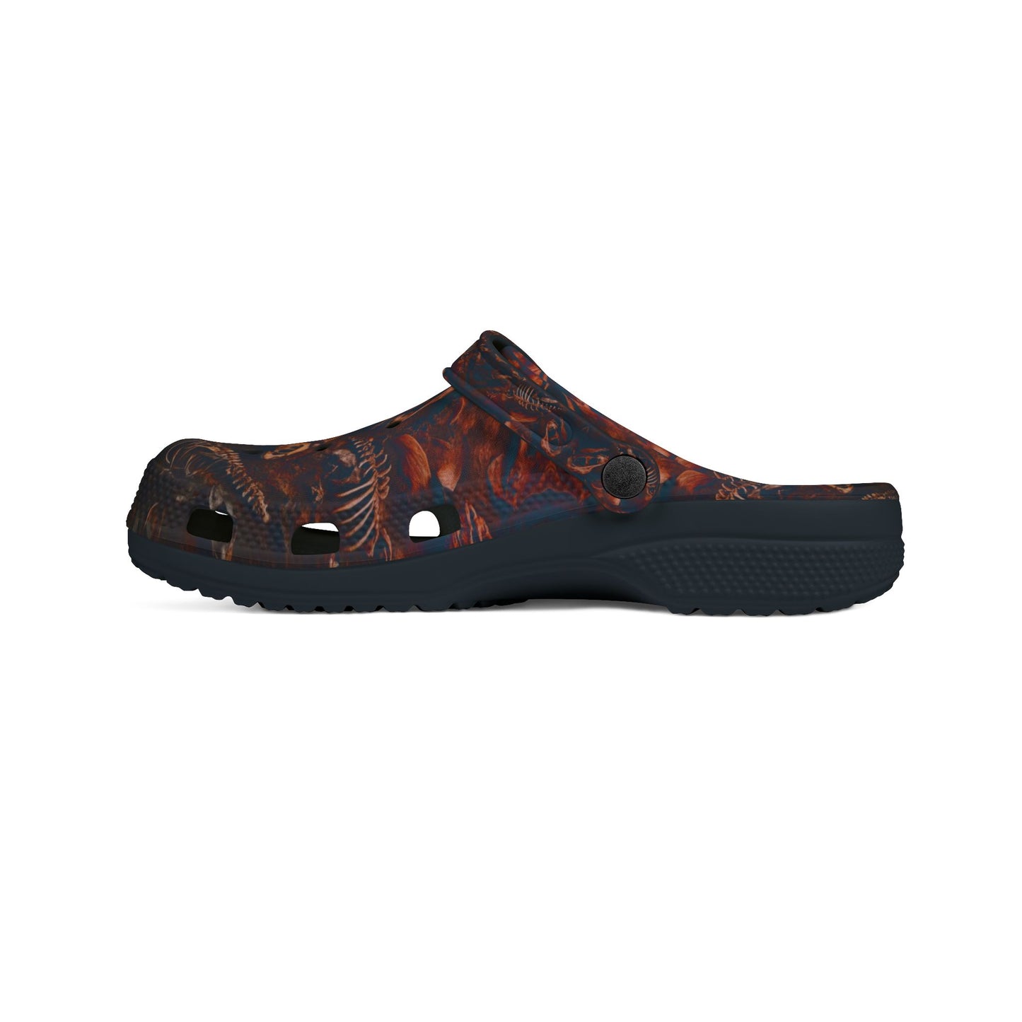CLOGS